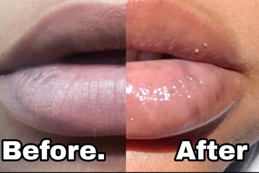 Lips Pink Kesy kary How to get rid darkness from Lips Make Lips Pink home remedies Ghar Par Lip Care Routine lips pink